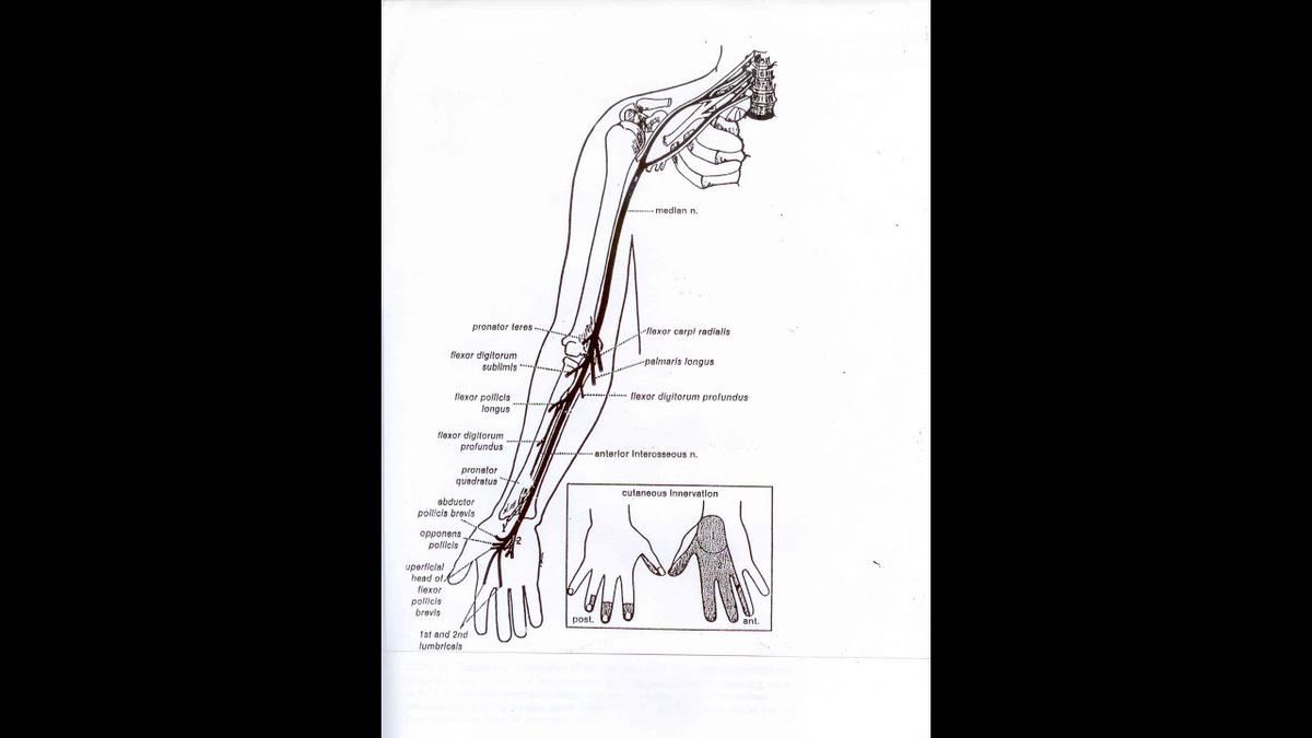 'Video thumbnail for Carpal tunnel syndrome #Shorts'